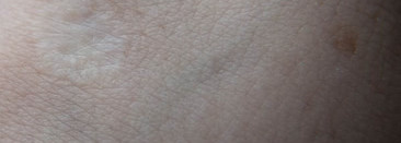 Гиалуроновый крем-филлер AquaFiller для кожи вокруг глаз Novosvit Pharma Laboratory