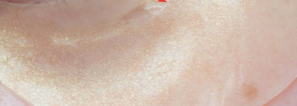 Petitfee Gold Hydrogel Eye Patch