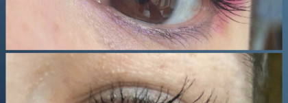 Xlash: до и после