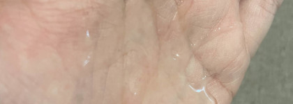 Фармтек представляет: Липобейз