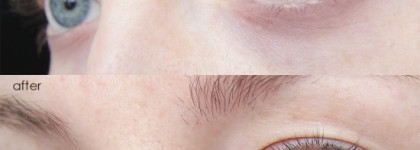 Крем, преображающий взгляд. Новинка: Clinique Pep-Start Eye Cream