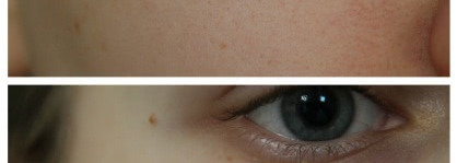 Улучшение состояния кожи с Kora Полирующий скраб тройного действия (+до/после)