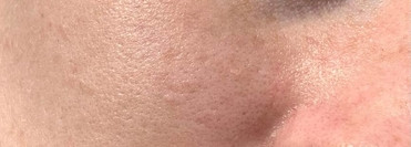 Базовый набор от M.aklive - серый кардинал в борьбе против гиперсекреции сальных желез