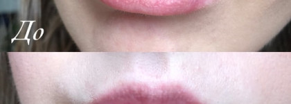 Mixit. Born to Love Gelly Lip Mask