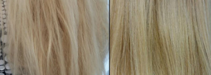 Поговорим о ботоксе