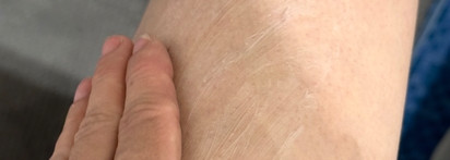 Атопикам посвящается: базовый SVR Crème Topialyse