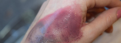 Гидрофильное масло Flower Bouquet Iris Fresh Cleansing Oil от Missha