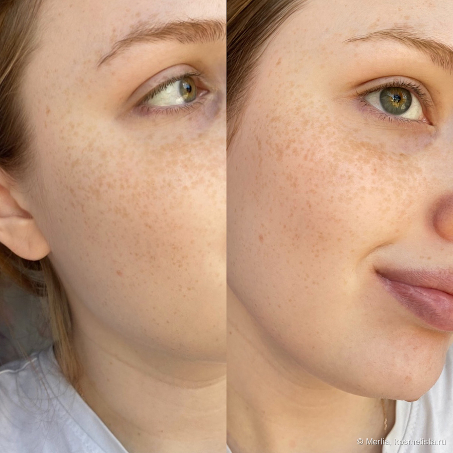 Слева - очищенная кожа "до", справа - кожа "после", протертая тонером