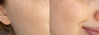 Максимально комфортное увлажнение кожи - корейский тонер для лица Jigott Aloe Aqua Balance Skin