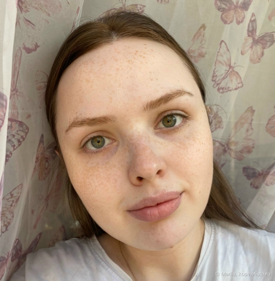 Кожа после умывания пенкой-муссом