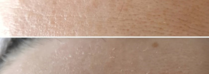 Как быстро убрать шелушения на примере использования кислотных дисков с АНА и Вна-Кислотами и 6-ю витаминами от A'pieu - Vitamin AC pads