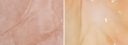 Мягкая очищающая эмульсия на масляной основе Skinsorica - Pore Care