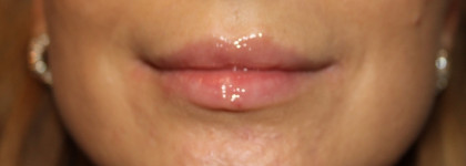 Отличный блеск-масло Essence Extreme Shine Volume Lipgloss 02 Summer Punch за 2€