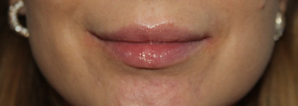 Отличный блеск-масло Essence Extreme Shine Volume Lipgloss 02 Summer Punch за 2€