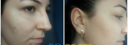 Люблю нежной любовью. Artdeco Hydra Mineral Compact Foundation - минерализированная пудра