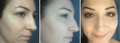 Люблю нежной любовью. Artdeco Hydra Mineral Compact Foundation - минерализированная пудра