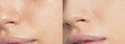 Штирлиц понял, что это провал... Make Up For Ever HD Skin 1N06 (Y218)