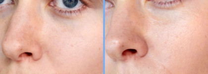 Estée Lauder Enlighten EE Even Effect Skintone Corrector SPF 30 в оттенке 01 Light