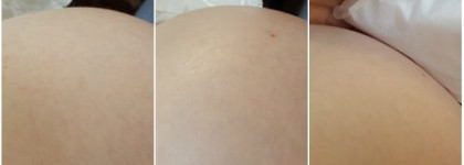 Ветер перемен или как подготовиться к изменениям фигуры и помочь коже не растянуться + бонус от неподкупного тестировщика. Крем против растяжек Clarins Stretch Mark Minimizer