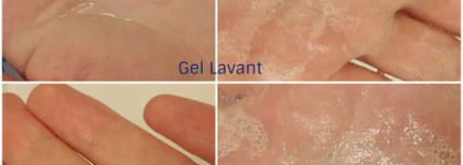 Моя история борьбы с кожным зудом. Большой обзор средств от La Roche-Posay