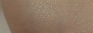 Моя история борьбы с кожным зудом. Продолжение о Sos-Средствах