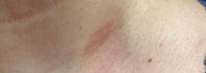 Tripeptide-R neck repair SkinCeuticals - лифтинг для шеи с трипептидом и ретинолом