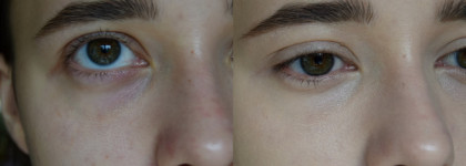 Laura Mercier Flawless Fusion Ultra-Longwear Concealer - 1N