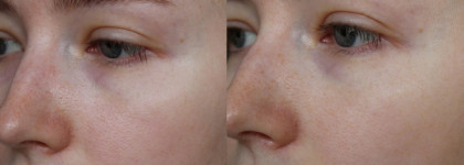 Уход от Aravia Laboratories: Ice Seaweed Algin Mask, Hydra Boost Mask, Winter Cream