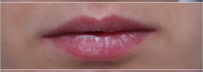 Крем-уход для контура глаз и губ с пептидами Aravia Professional