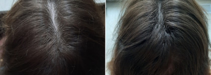 Два средства для уплотнения и роста волос Nioxin