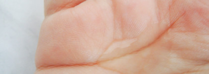 Азелаиновая кислота для ухода за проблемной кожей в пилинге Aravia Laboratories Anti-Acne Peeling