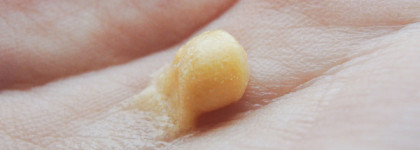 Топовые средства для проблемной кожи лица с акне