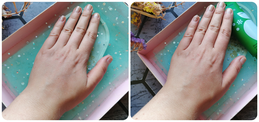 до и после использования крема