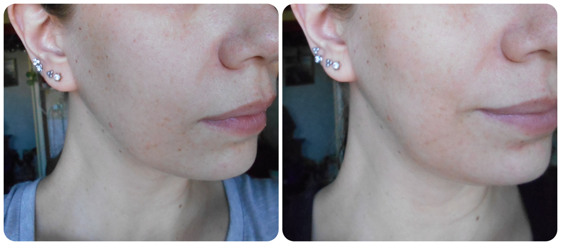 до и спустя несколько дней