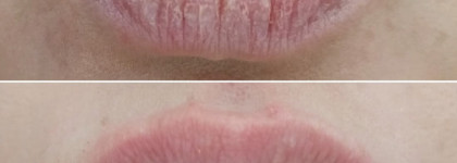 Натуральный помощник - ягодный скраб для губ от "Спивакъ"