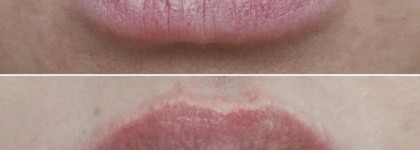 Натуральный помощник - ягодный скраб для губ от "Спивакъ"