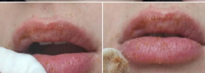 Натуральный помощник - ягодный скраб для губ от "Спивакъ"