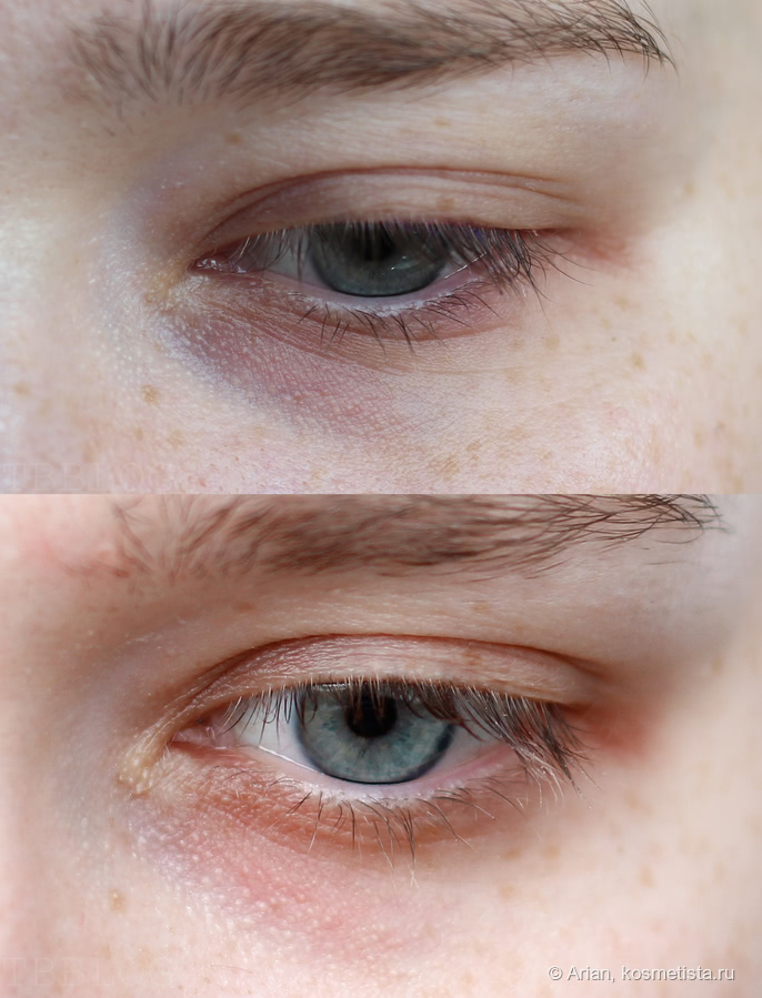 Creamy eye treatment для кожи вокруг глаз купить