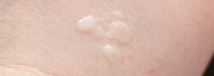 Фавориты 2020: уход для сухой, чувствительной и проблемной кожи