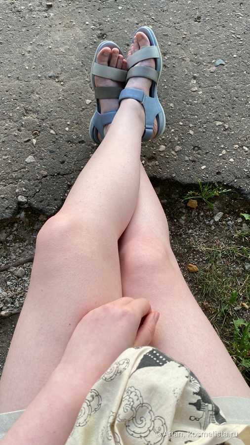 Бледные ноги с растяжками