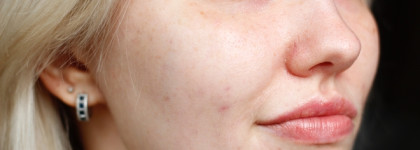 О моём уходе за чувствительной кожей