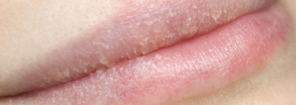 Восстанавливающие бальзамы Pure Paw Paw Ointment: один спасает, а два просто за компанию