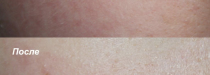 Мучает сухость после умывания? Supple Preparation Facial Toner от Klairs всё исправит