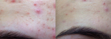 Тональный крем-флюид Maybelline Fit Me Matte + Poreless normal to oily