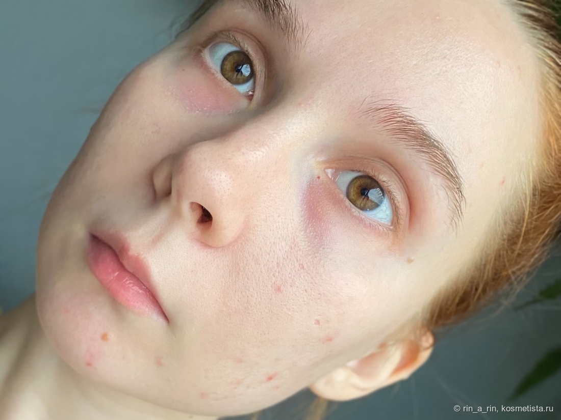 Только с дневным уходом.