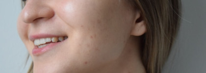 Мое спасение от La Roche-Posay
