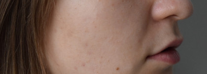 Мое спасение от La Roche-Posay
