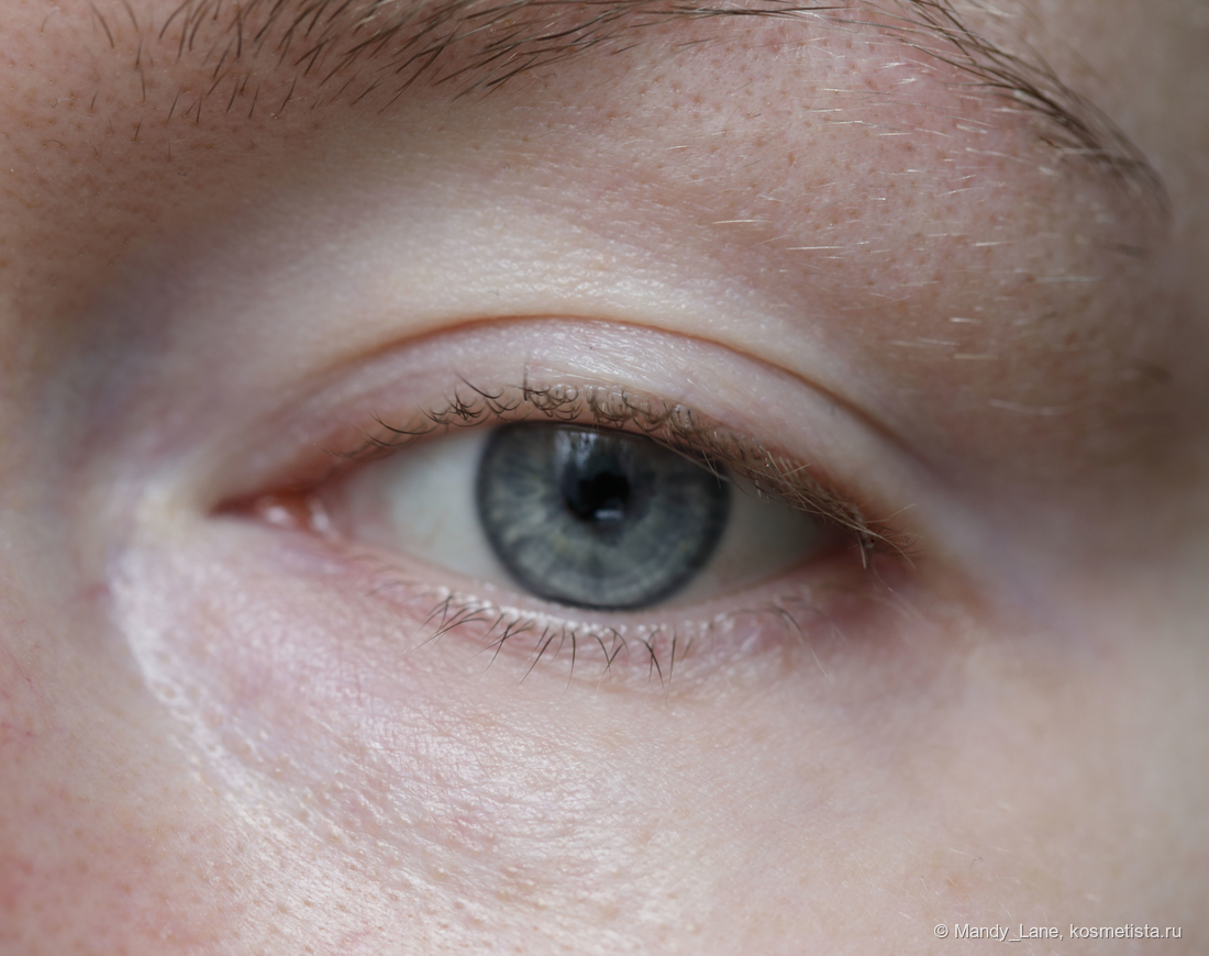 Состояние кожи до начала тестирования Clarins Total Eye Lift Lift-replenishing eye concentrate