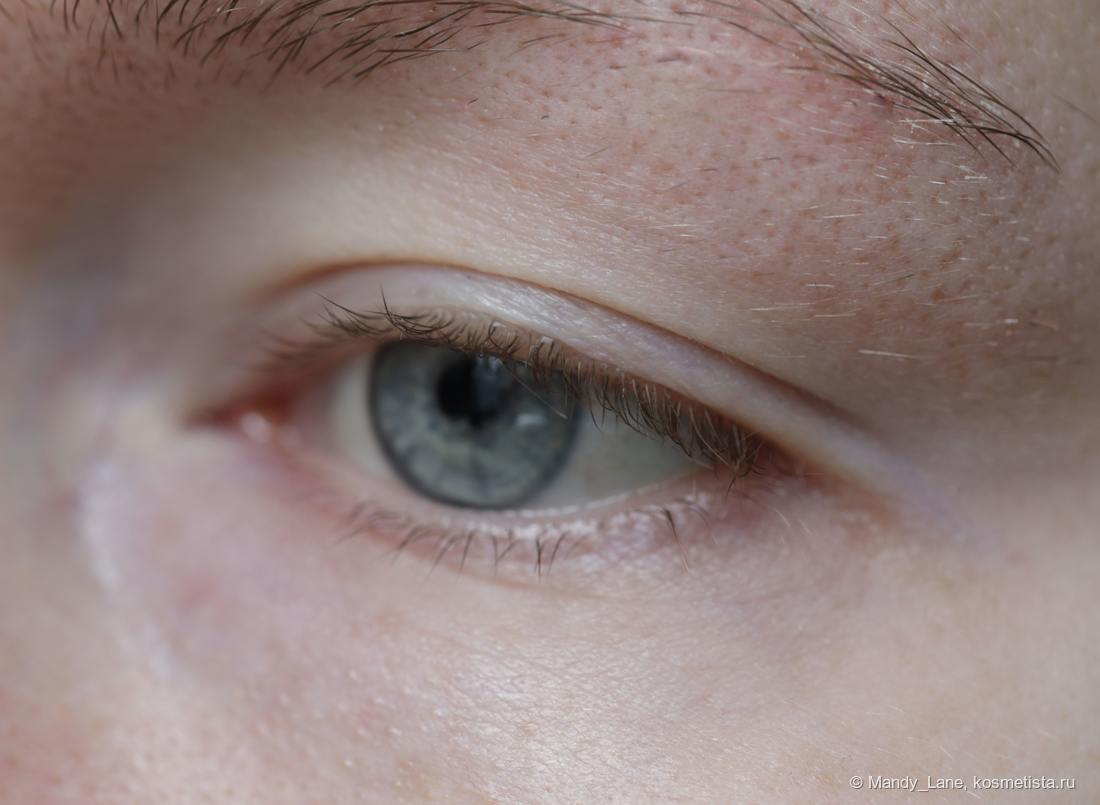 Состояние кожи до начала тестирования Clarins Total Eye Lift Lift-replenishing eye concentrate