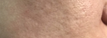 Преображение кожи с пилингом от Kiehl's